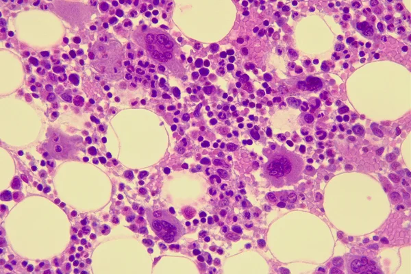 Bone Marrow (2)